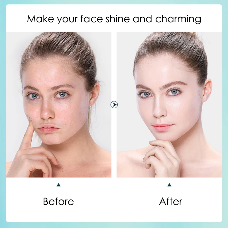 10pcs Hyaluronic Acid Hydratin - Sheet Face Mask Pack recension och pris